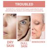 EELHOE Squalane Vc Rose Moisturizing Cream, Anti Dull Moisturizing Firming Brightening Face Cream
